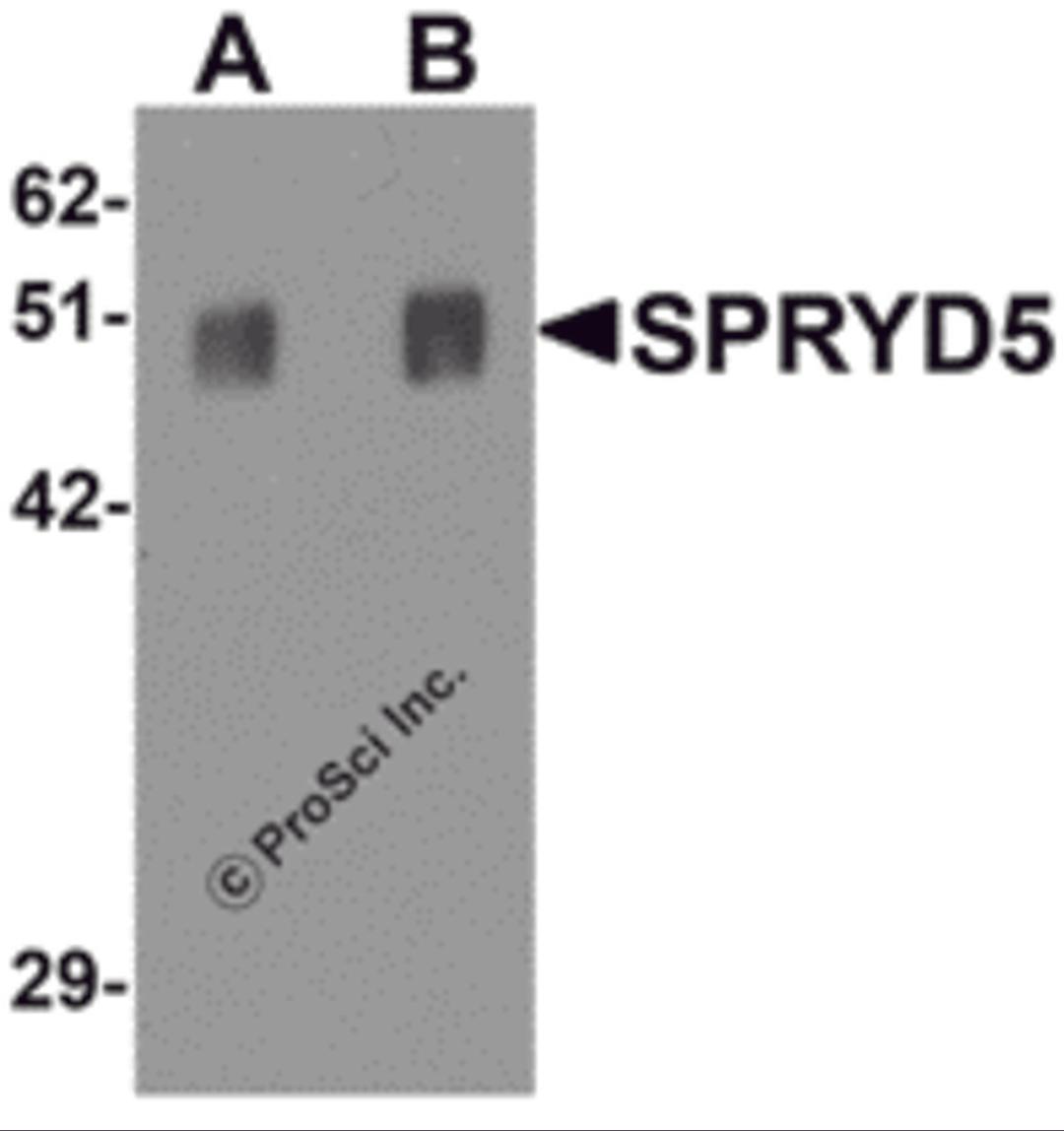 Western blot analysis of SPRYD5 in rat brain tissue lysate with SPRYD5 antibody at (A) 0.25 and (B) 0.5 μg/mL .