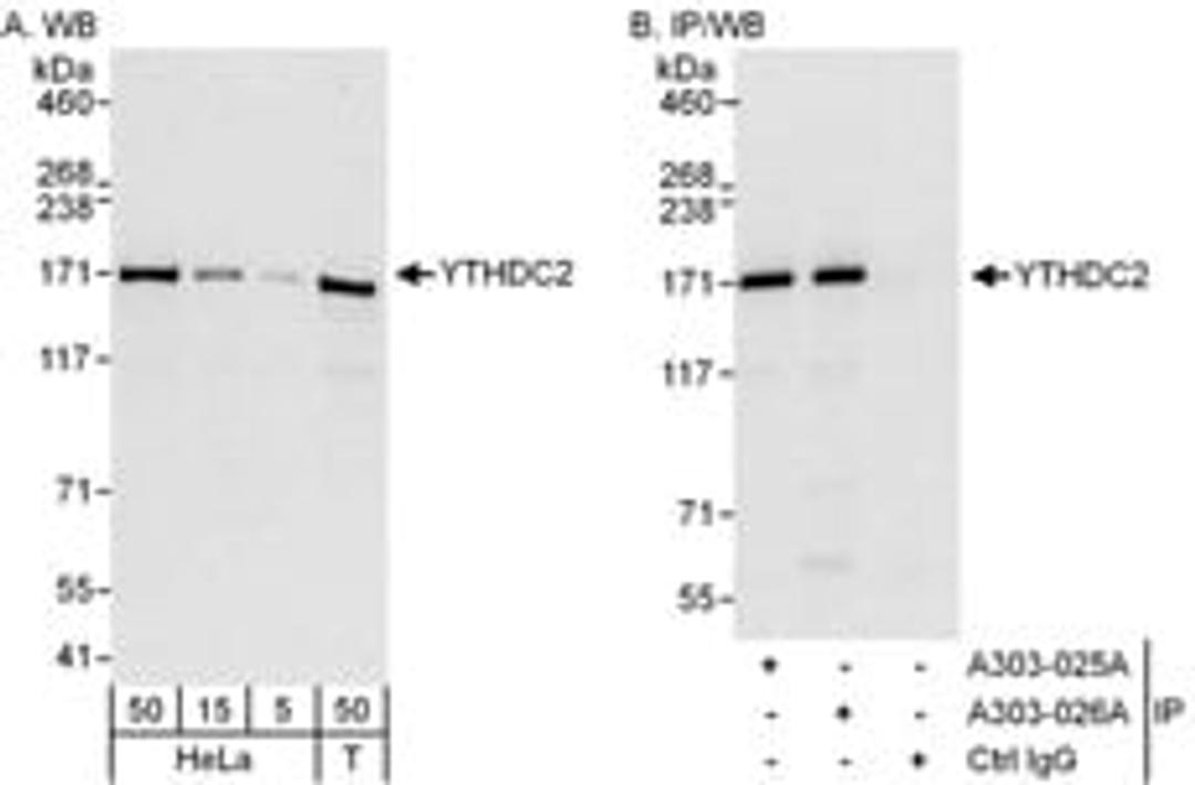 Detection of human YTHDC2 by western blot and immunoprecipitation.