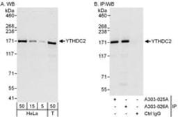 Detection of human YTHDC2 by western blot and immunoprecipitation.