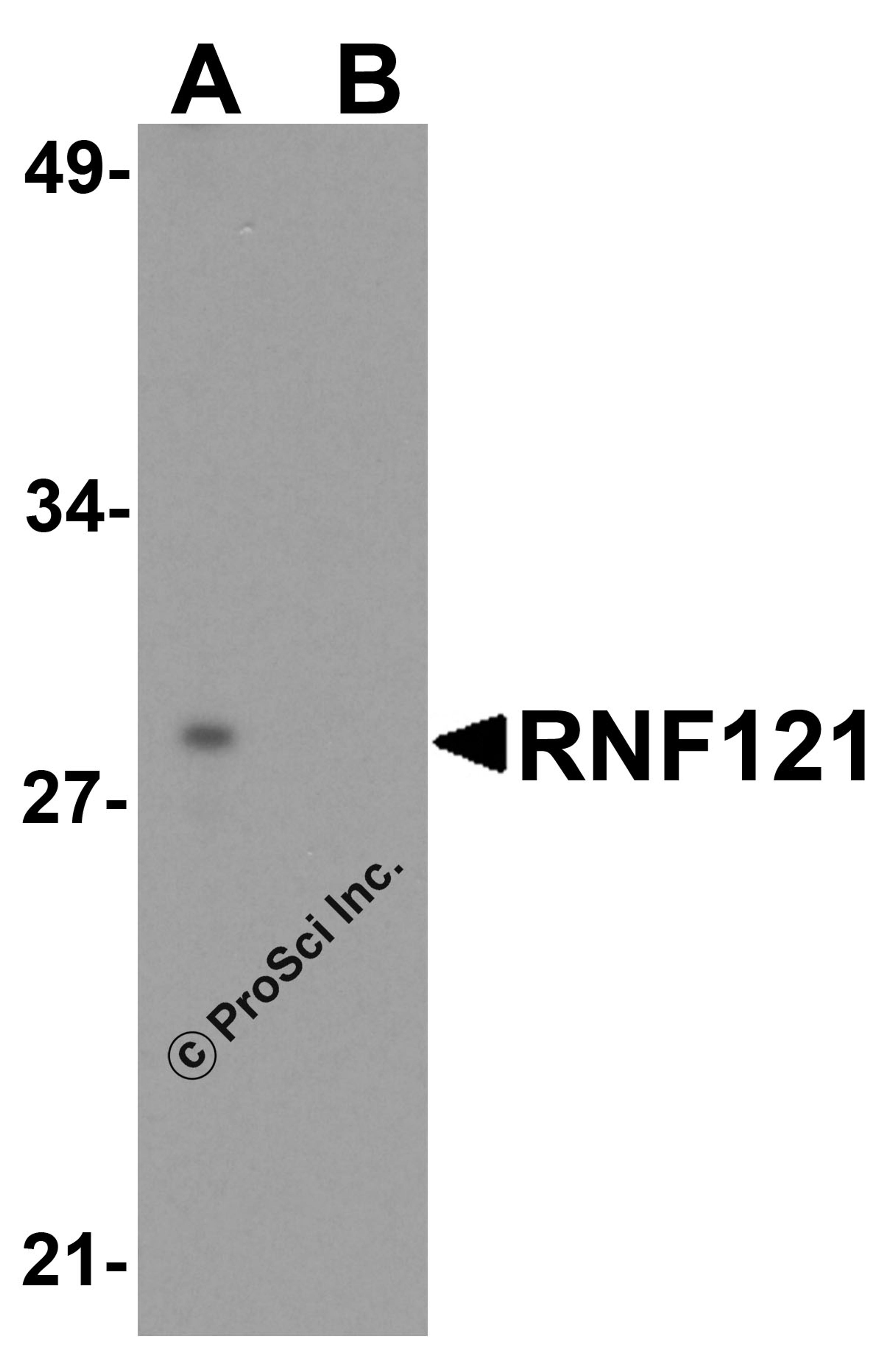 Western blot analysis of RNF121 in MCF7 cell lysate with RNF121 antibody at 1 μg/ml in (A) the absence and (B) the presence of blocking peptide.