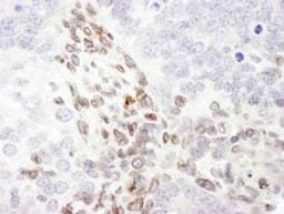 Detection of mouse Lamin-A by immunohistochemistry.