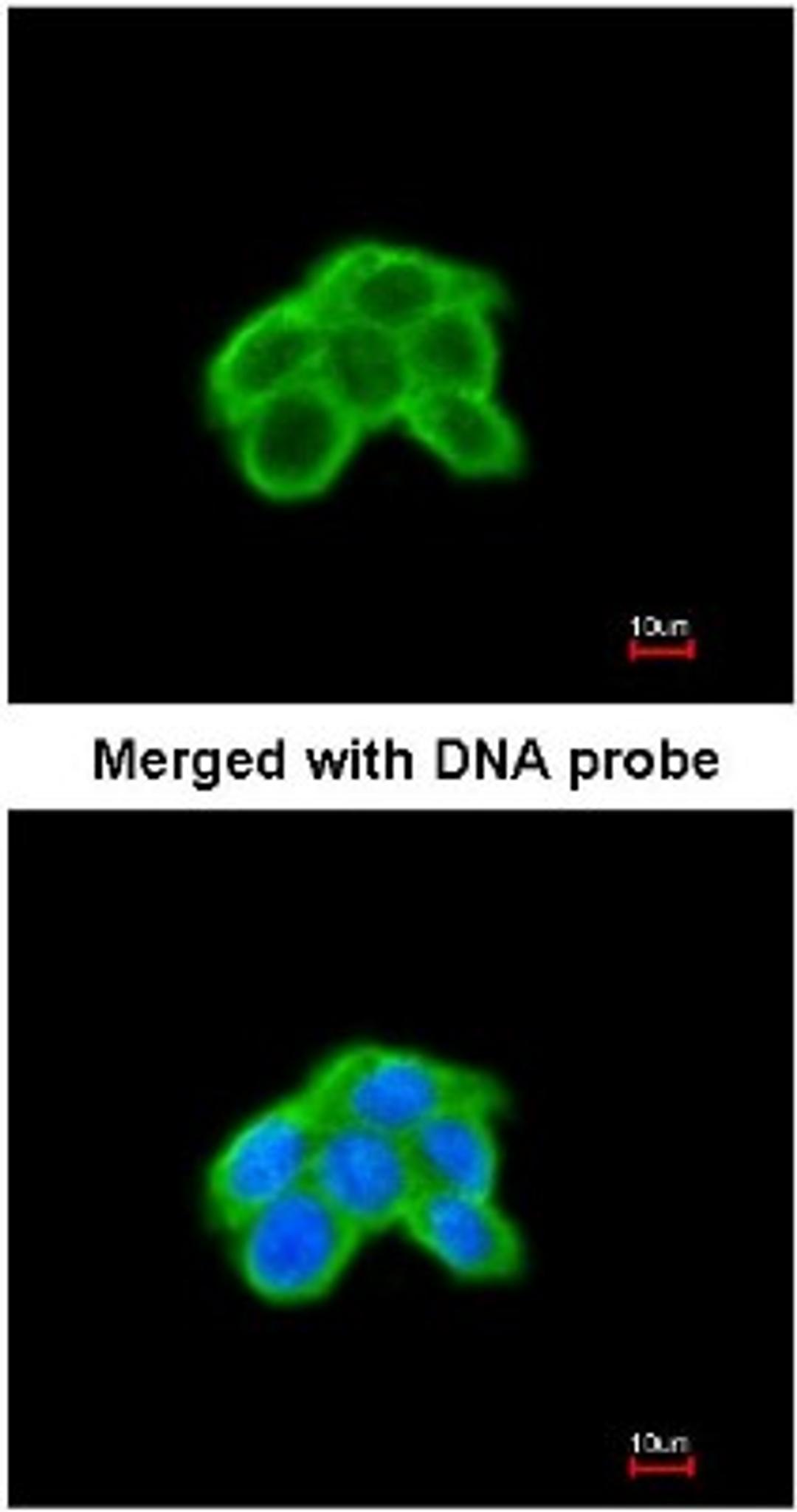 Immunocytochemistry/Immunofluorescence: DUSP9 Antibody [NBP1-31227] - Analysis of A431, using DUSP9 antibody at 1:200 dilution.