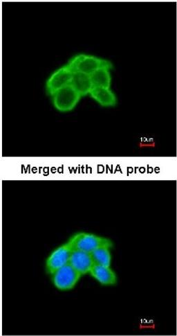 Immunocytochemistry/Immunofluorescence: DUSP9 Antibody [NBP1-31227] - Analysis of A431, using DUSP9 antibody at 1:200 dilution.