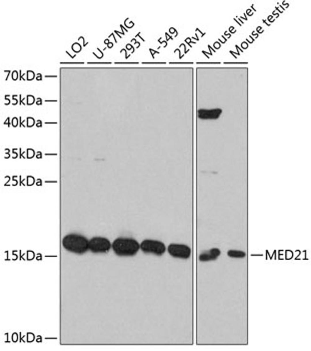 Western blot - MED21 antibody (A12168)