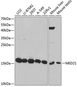 Western blot - MED21 antibody (A12168)