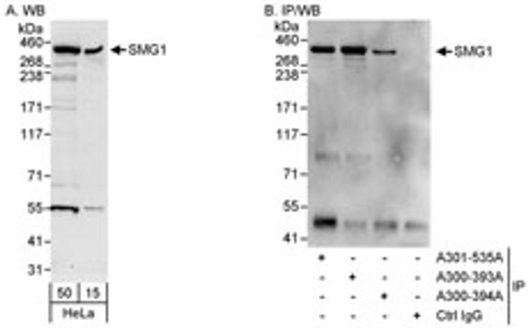 Detection of human SMG1 by western blot and immunoprecipitation.