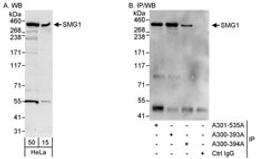 Detection of human SMG1 by western blot and immunoprecipitation.