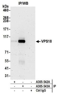 Detection of human VPS18 by western blot of immunoprecipitates.