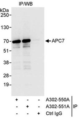 Detection of human APC7 by western blot of immunoprecipitates.