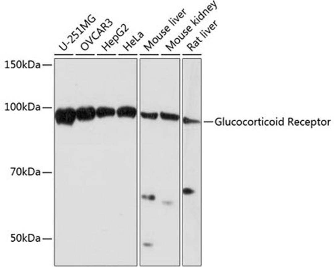 Western blot - Glucocorticoid Receptor antibody (A19583)