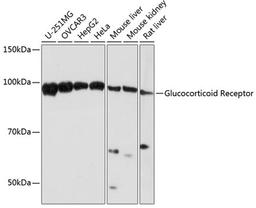 Western blot - Glucocorticoid Receptor antibody (A19583)