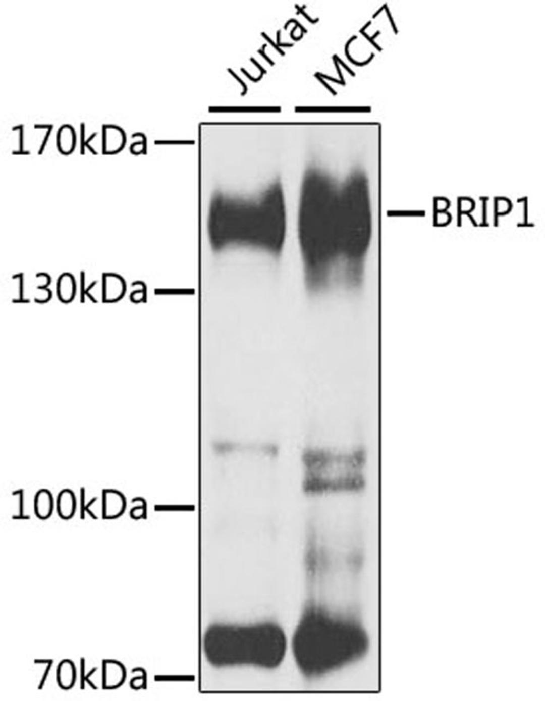 Western blot - BRIP1 antibody (A6804)