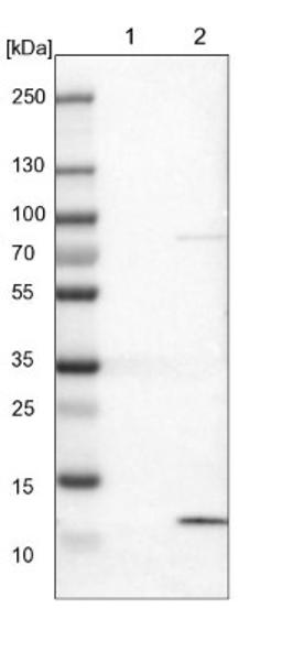 Western Blot: S100A13 Antibody [NBP1-86039] - Lane 1: NIH-3T3 cell lysate (Mouse embryonic fibroblast cells)<br/>Lane 2: NBT-II cell lysate (Rat Wistar bladder tumour cells)