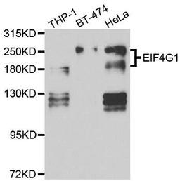 Western blot analysis of extracts of various cell lines using EIF4G antibody