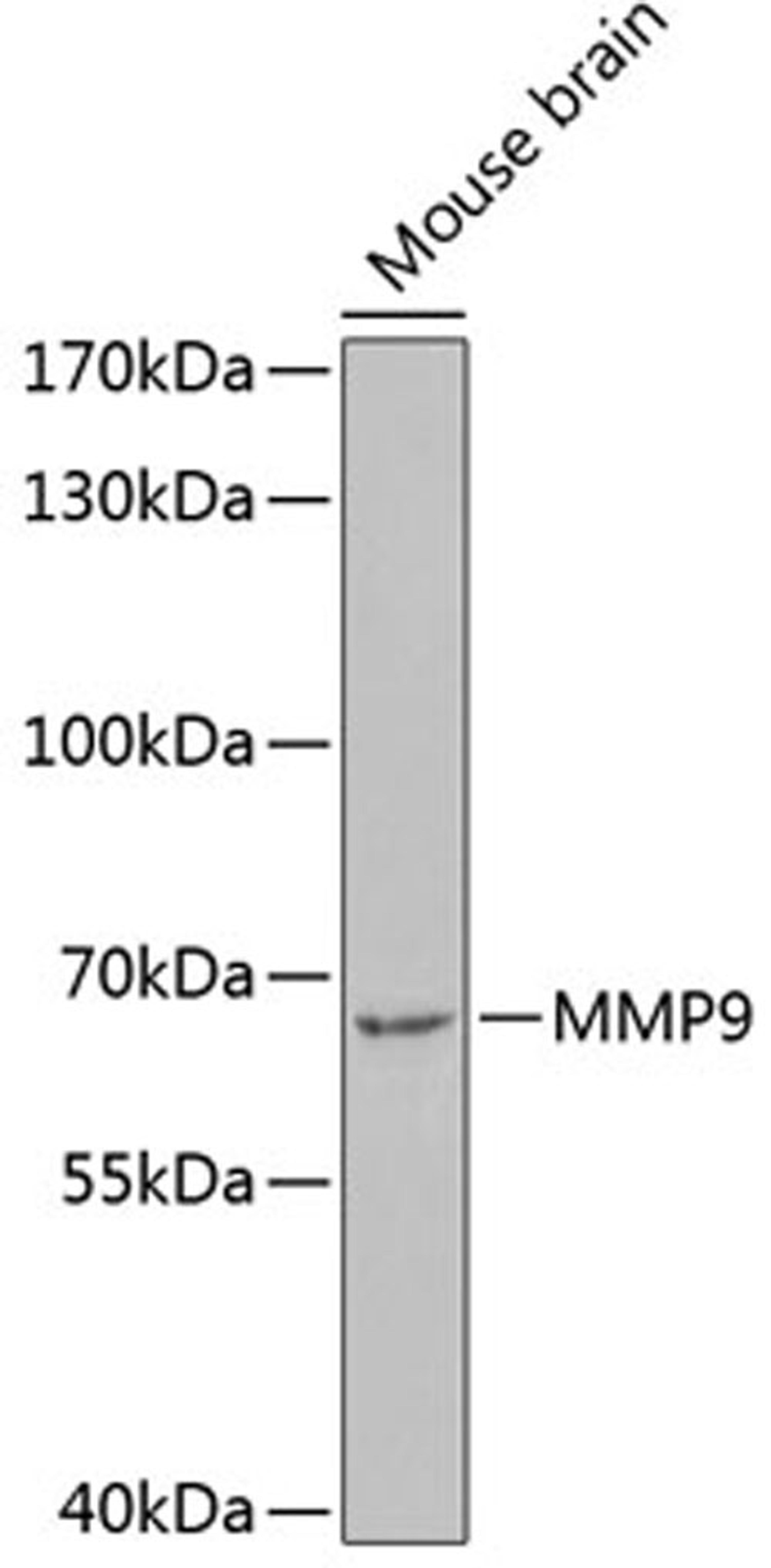 Western blot - MMP9 antibody (A11391)