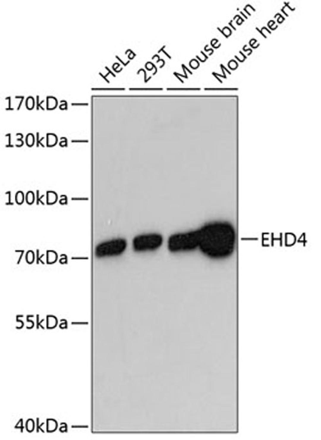 Western blot - EHD4 antibody (A13766)