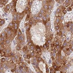 Immunohistochemistry: WDR93 Antibody [NBP2-32041] - Staining of human liver shows strong cytoplasmic positivity in hepatocytes.