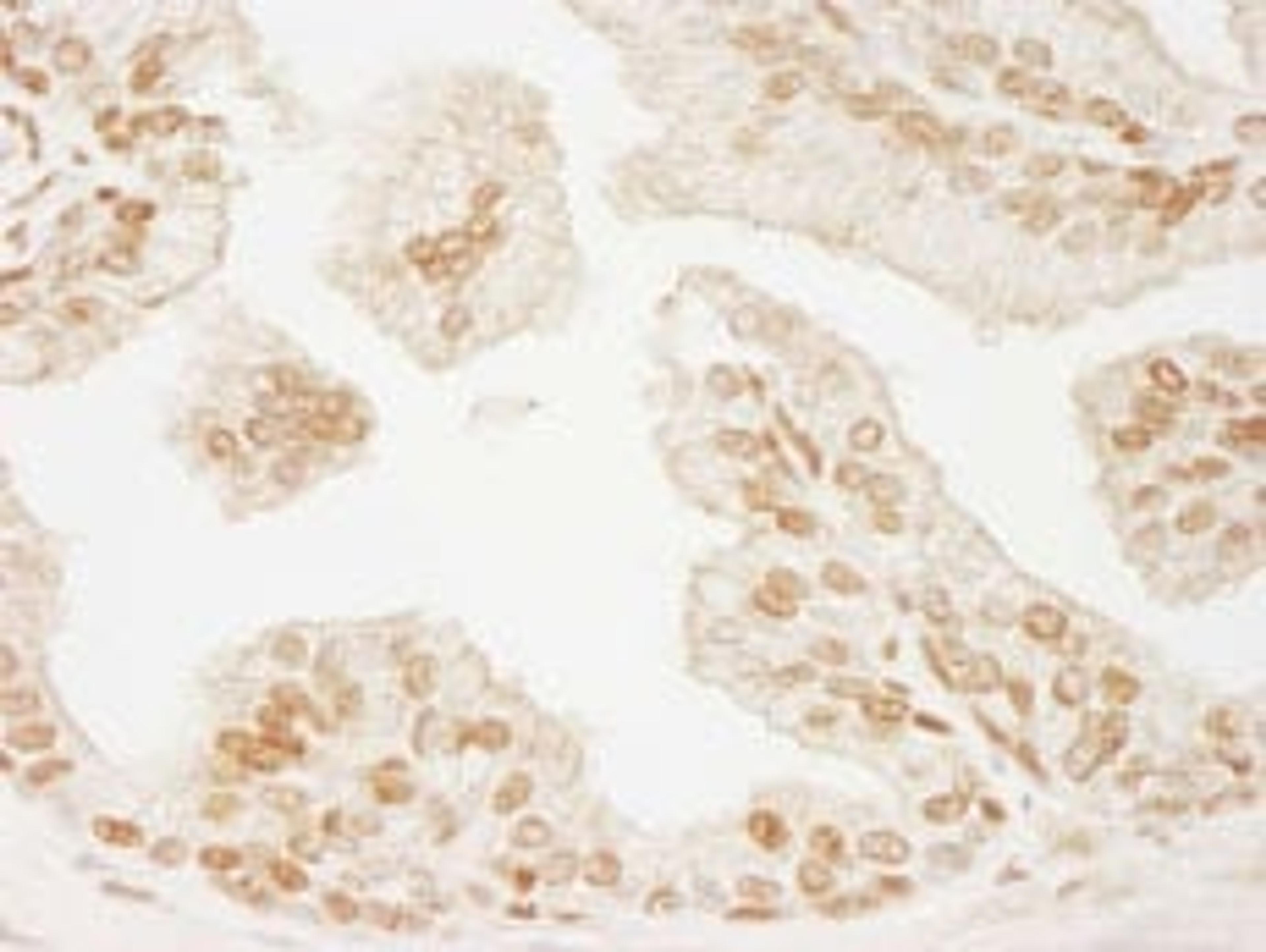 Detection of human PML by immunohistochemistry.