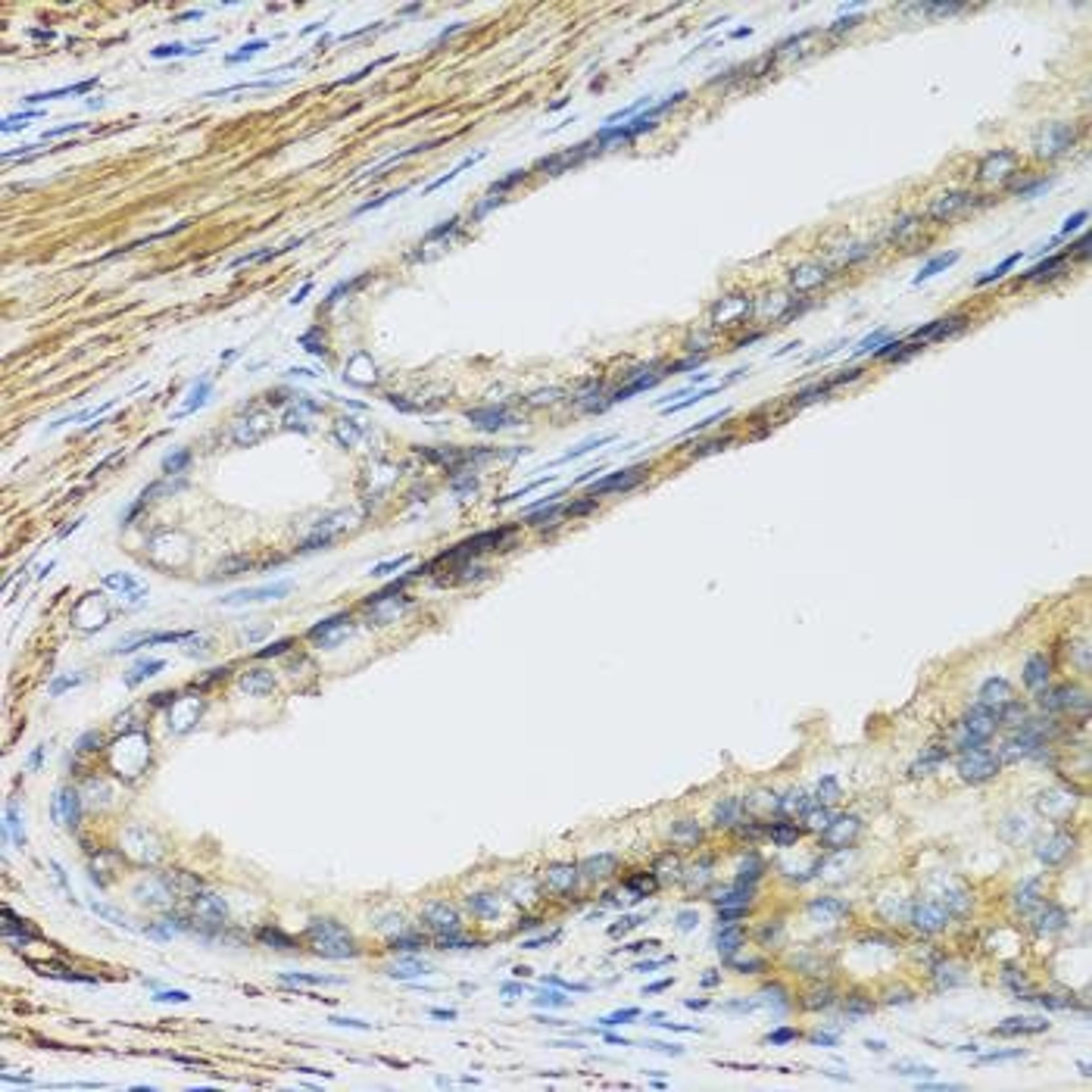 Immunohistochemical staining of human liver tissue using CSH1 antibody (dilution of 1:100)