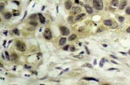 Immunohistochemistry-Paraffin: Nbs1 [p Ser343] Antibody [NB100-92610] - NBS1 Phosphospecific Antibody (S343) [NB100-92610] - Immunohistochemistry (IHC) analyzes antibody in paraffin-embedded human tonsil  tissue.