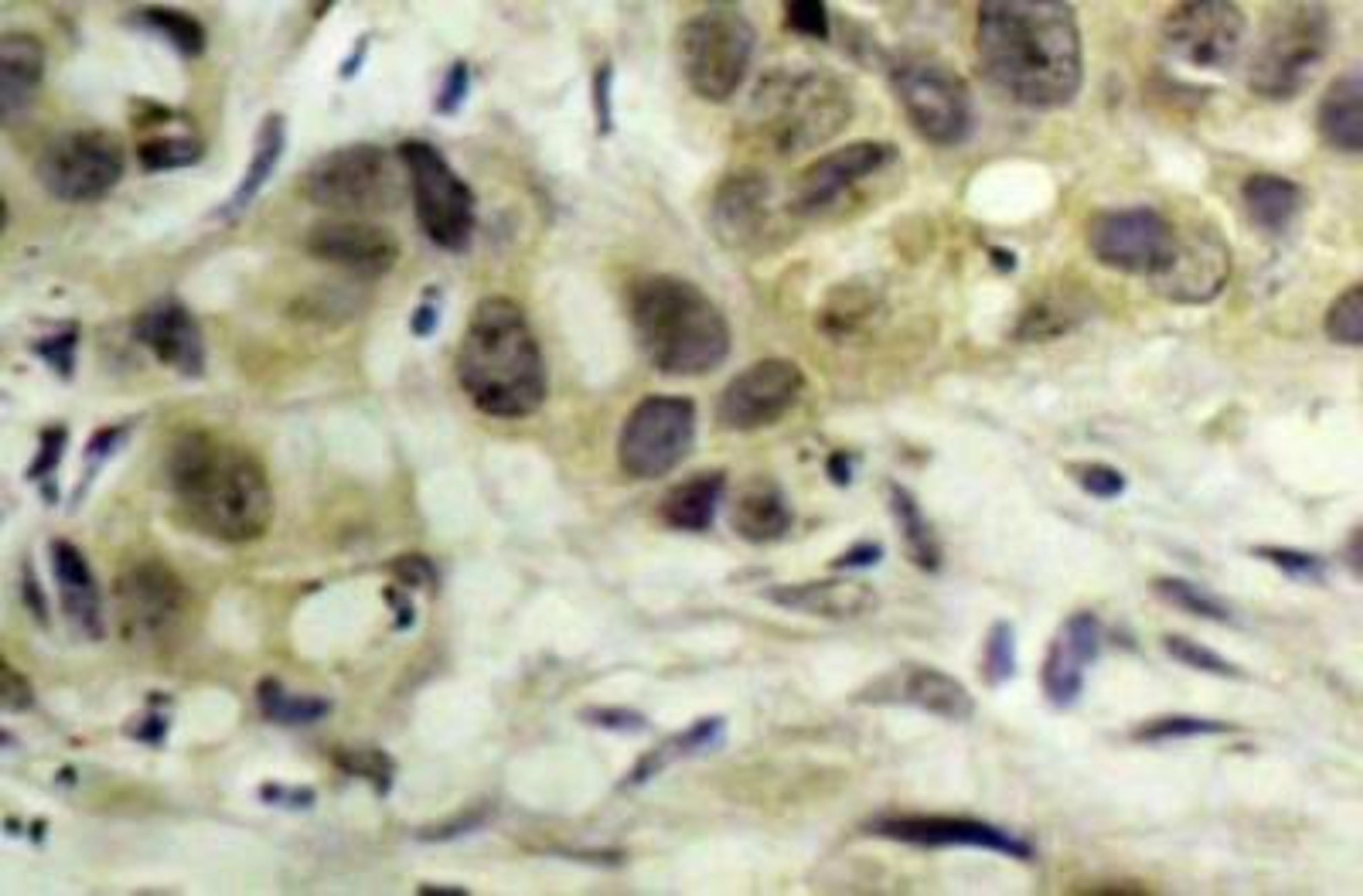 Immunohistochemistry-Paraffin: Nbs1 [p Ser343] Antibody [NB100-92610] - NBS1 Phosphospecific Antibody (S343) [NB100-92610] - Immunohistochemistry (IHC) analyzes antibody in paraffin-embedded human tonsil  tissue.