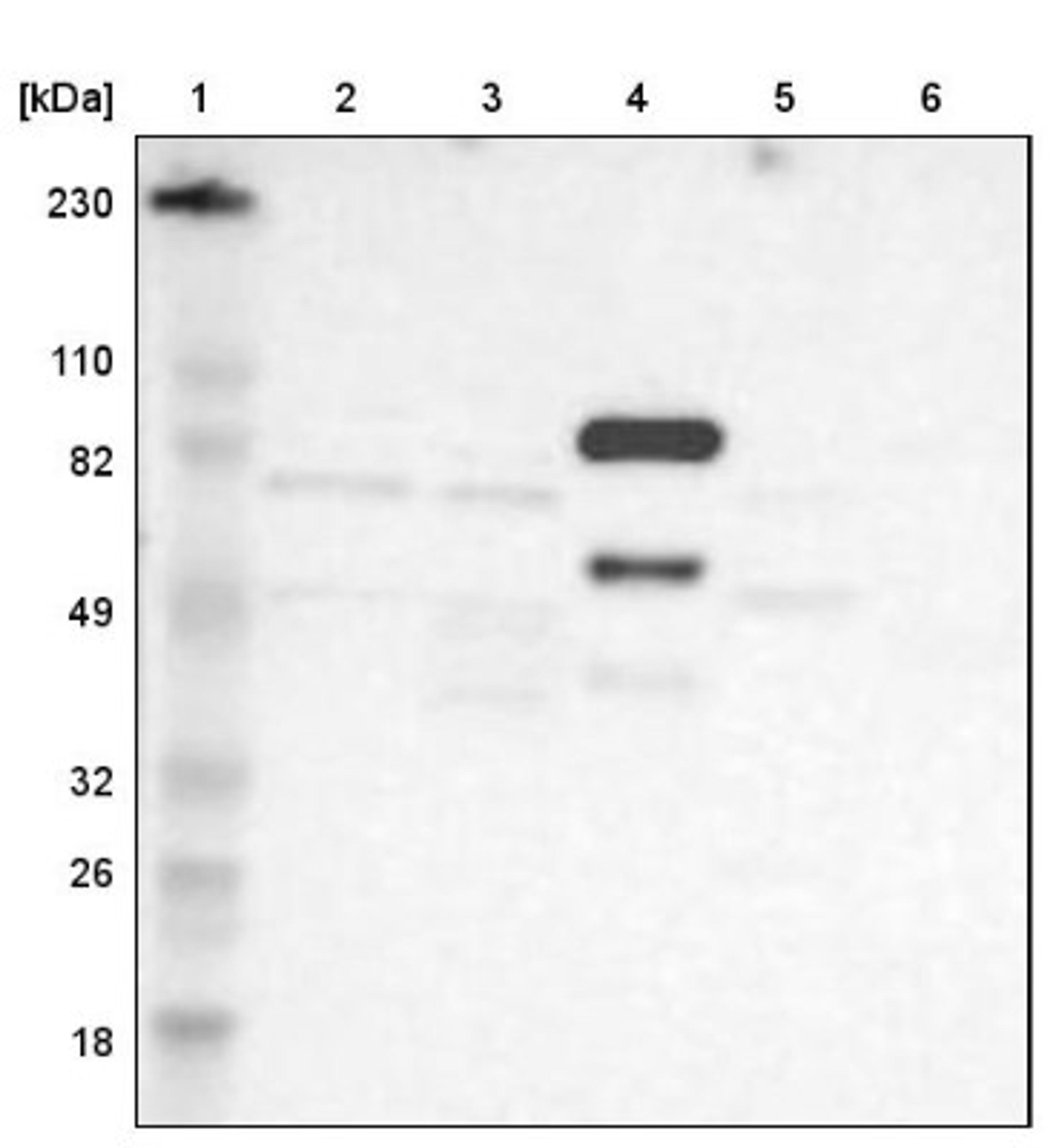 Western Blot: Factor XIII Antibody [NBP1-89811] - Lane 1: Marker [kDa] 230, 110, 82, 49, 32, 26, 18<br/>Lane 2: Human cell line RT-4<br/>Lane 3: Human cell line U-251MG sp<br/>Lane 4: Human plasma (IgG/HSA depleted)<br/>Lane 5: Human liver tissue<br/>Lane 6: Human tonsil tissue