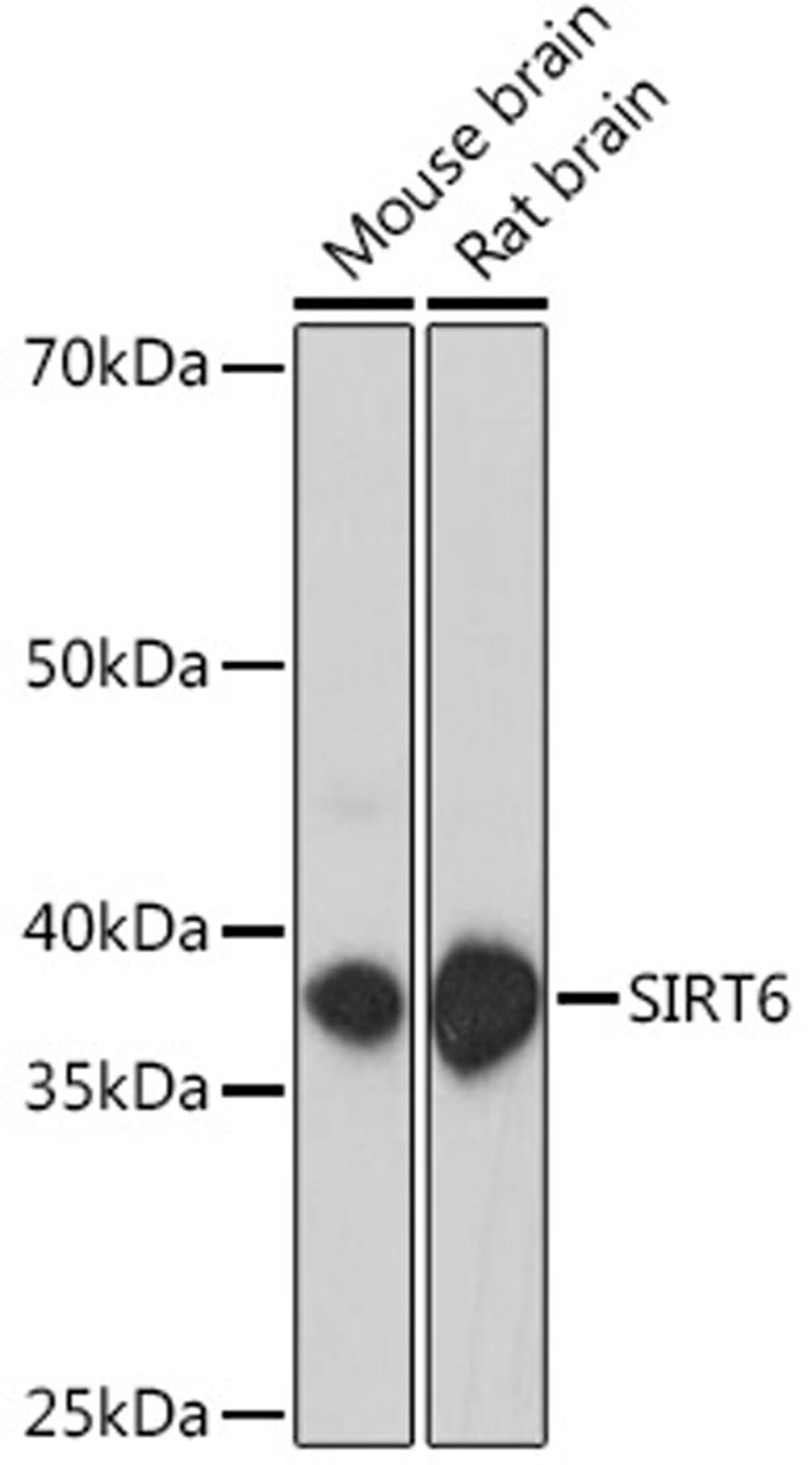 Western blot - SIRT6 antibody (A18468)