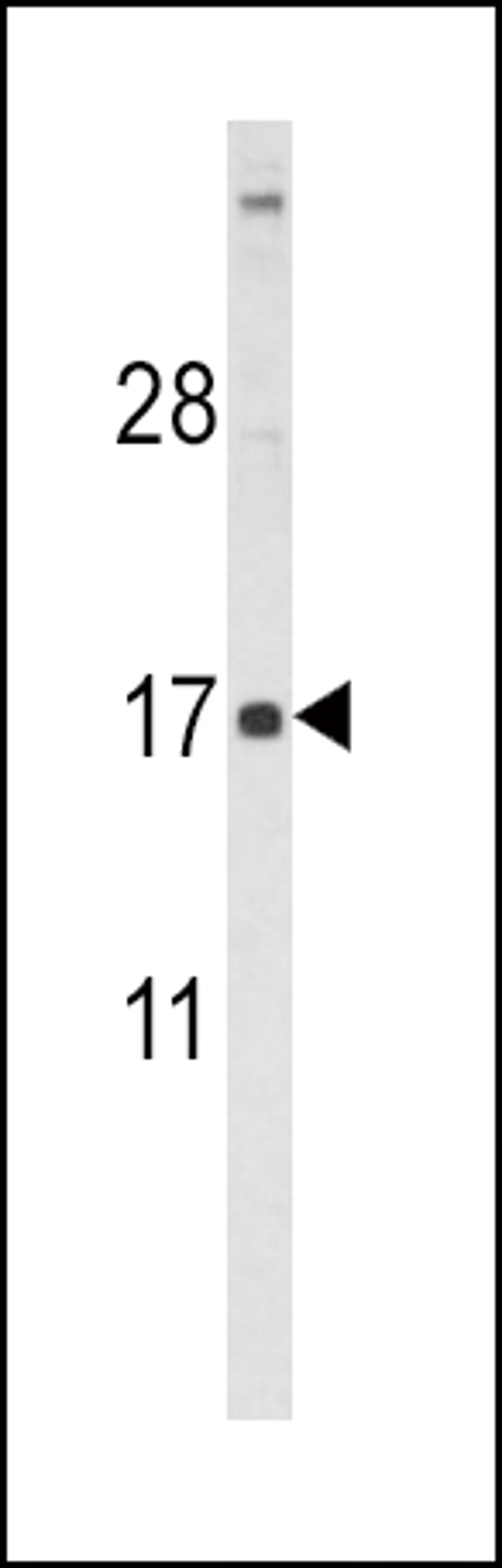 Western blot analysis of FSHB Antibody (Center T70) in HL60 cell line lysates (35ug/lane)