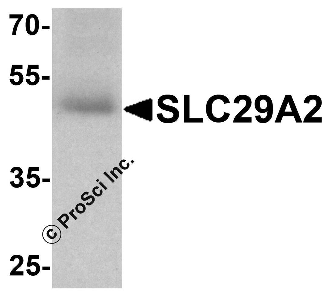 Western blot analysis of SLC29A2 in human bladder tissue lysate with SLC29A2 antibody at 1 μg/ml.