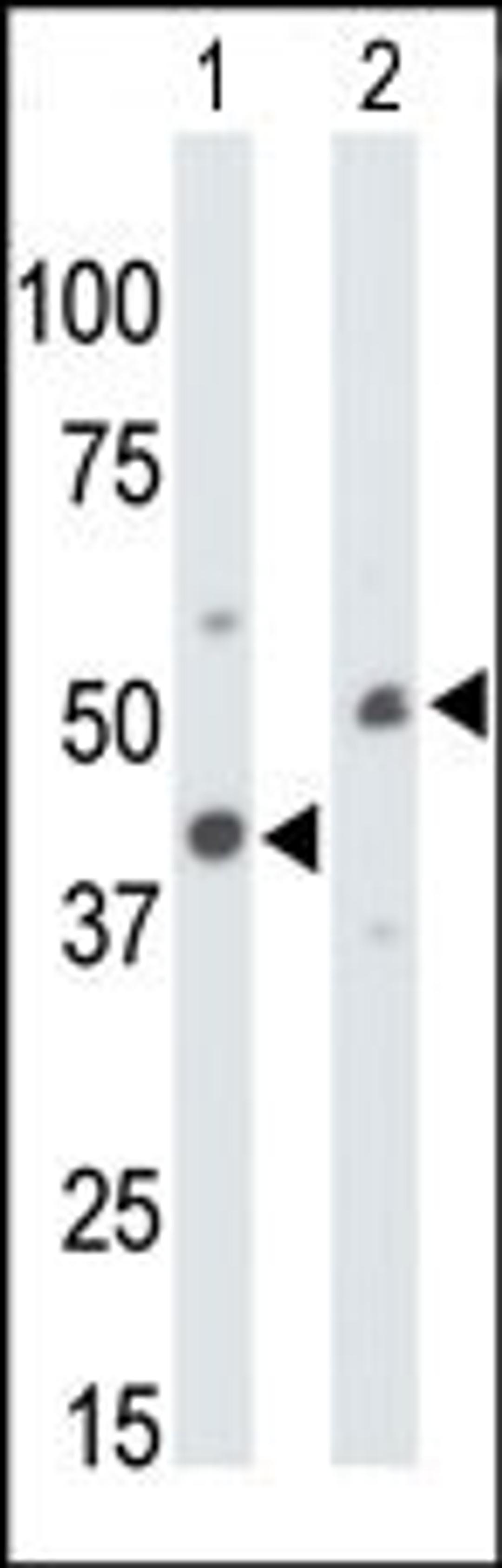 Antibody is used in Western blot to detect CKMT1 in mouse colon tissue lysate (Lane 1) and ZR-75-1 cell lysate (Lane 2).