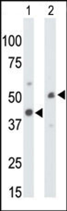 Antibody is used in Western blot to detect CKMT1 in mouse colon tissue lysate (Lane 1) and ZR-75-1 cell lysate (Lane 2).