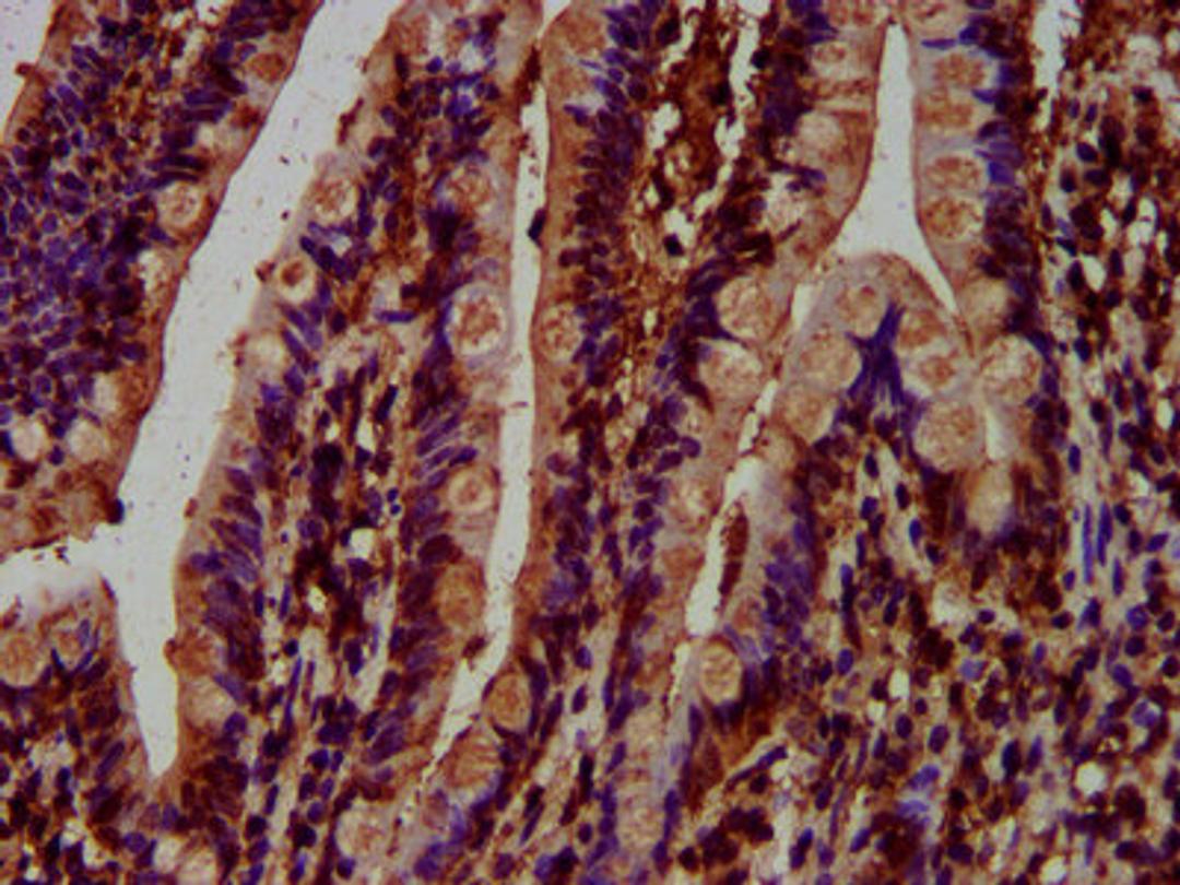 IHC image of CSB-PA013571LA01HU diluted at 1:500 and staining in paraffin-embedded human small intestine tissue performed on a Leica BondTM system. After dewaxing and hydration, antigen retrieval was mediated by high pressure in a citrate buffer (pH 6.0). Section was blocked with 10% normal goat serum 30min at RT. Then primary antibody (1% BSA) was incubated at 4&deg;C overnight. The primary is detected by a biotinylated secondary antibody and visualized using an HRP conjugated SP system.