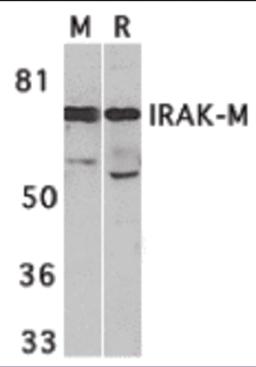 Western blot analysis of IRAK-M in (M) mouse spleen and (R) rat liver tissue lysates with IRAK-M antibody at 1 &#956;g/mL.