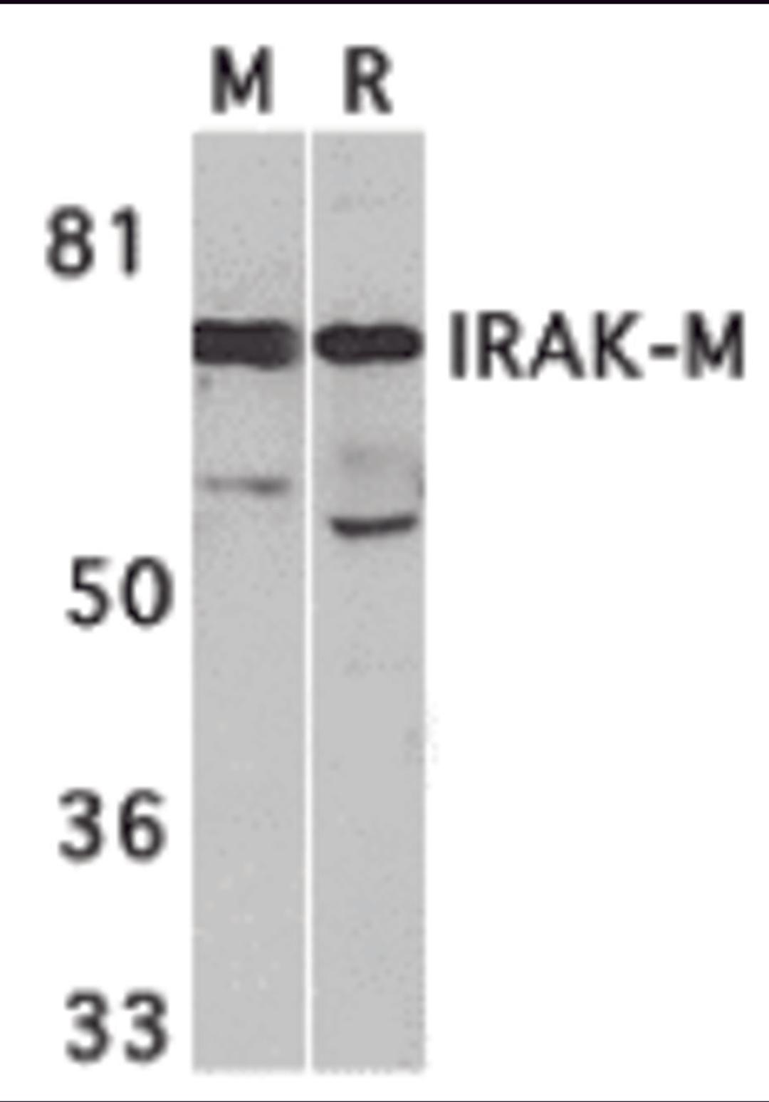 Western blot analysis of IRAK-M in (M) mouse spleen and (R) rat liver tissue lysates with IRAK-M antibody at 1 μg/mL.