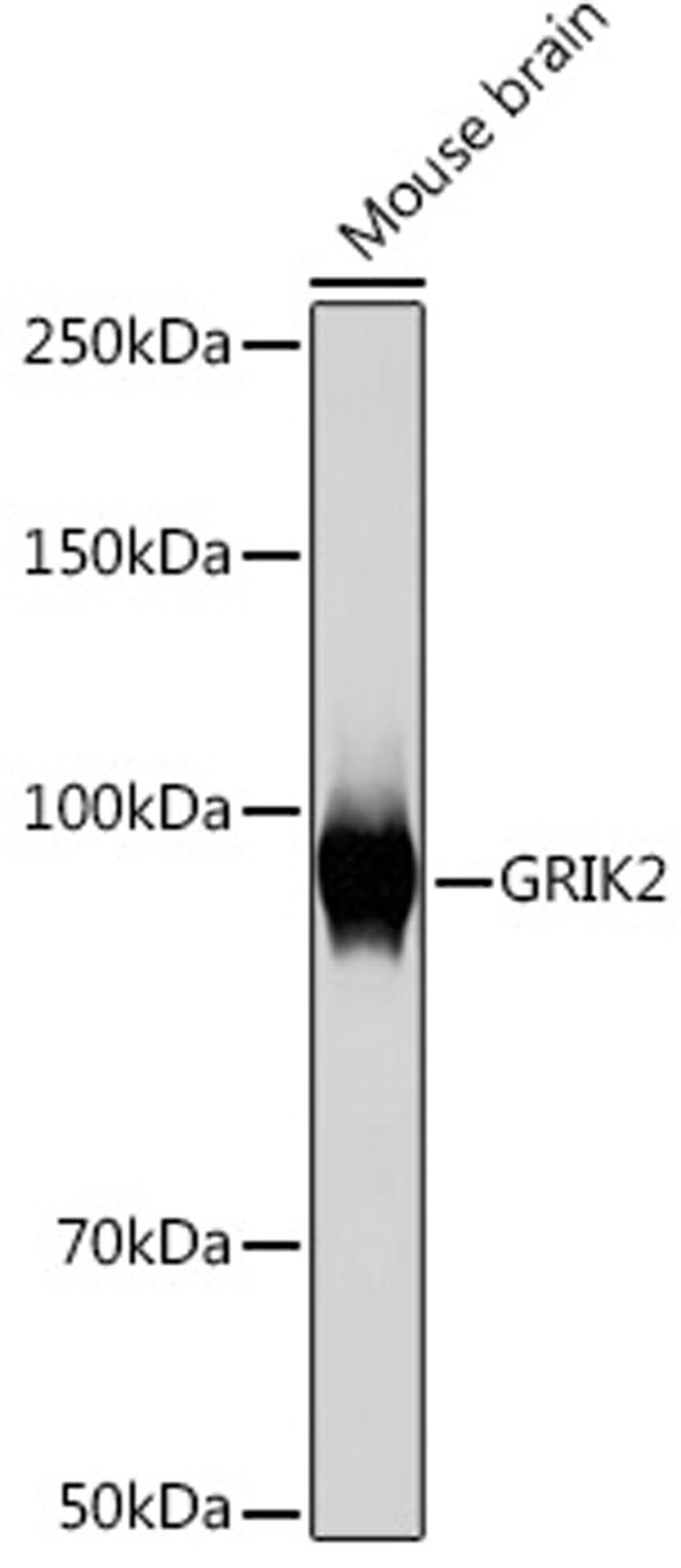 Western blot - GRIK2 Rabbit mAb (A9722)