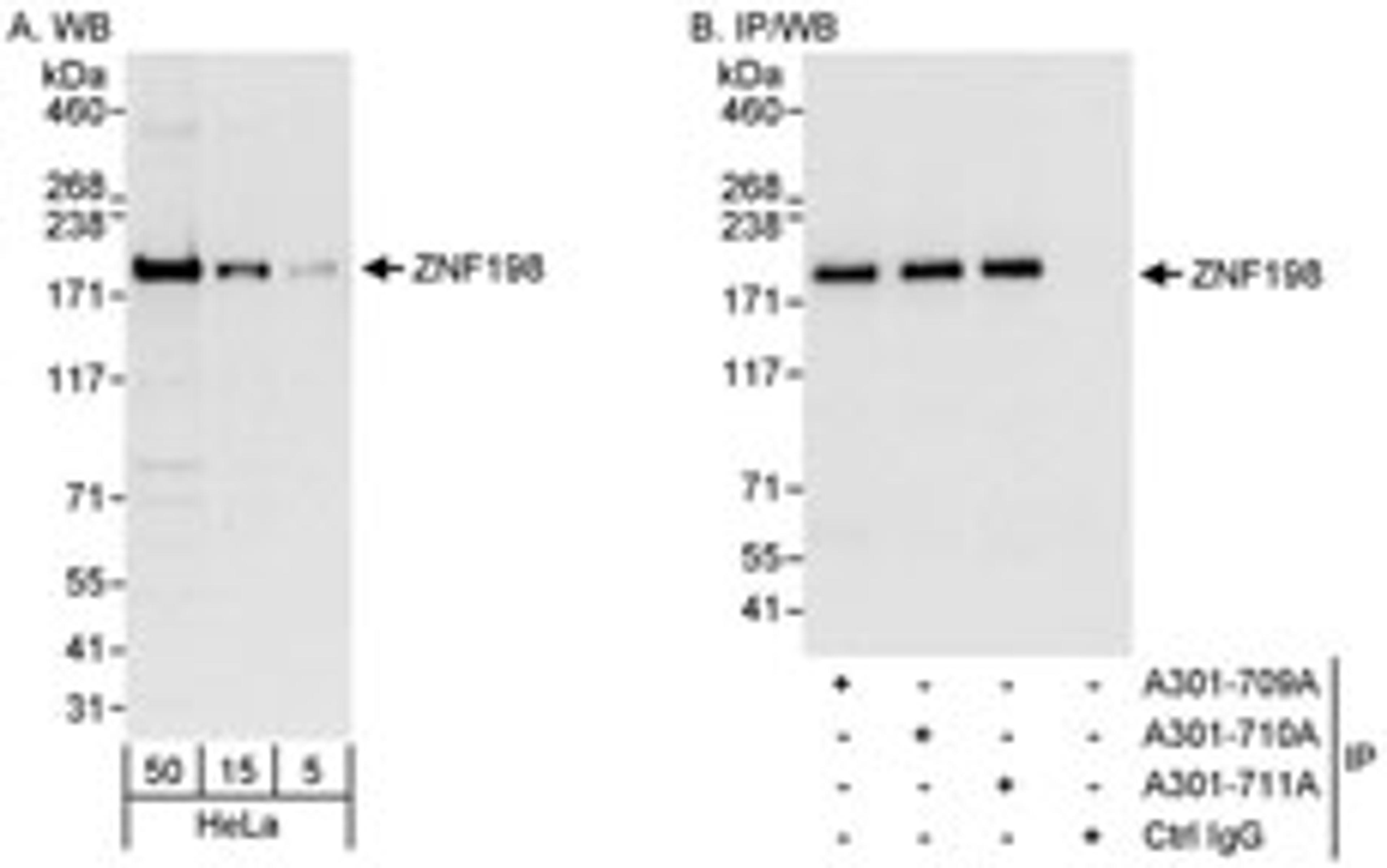 Detection of human ZNF198 by western blot and immunoprecipitation.