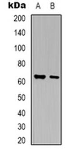 Western blot analysis of Arylsulfatase G expression in HEK293T (Lane 1), mouse liver (Lane 2) whole cell lysates using ARSG antibody