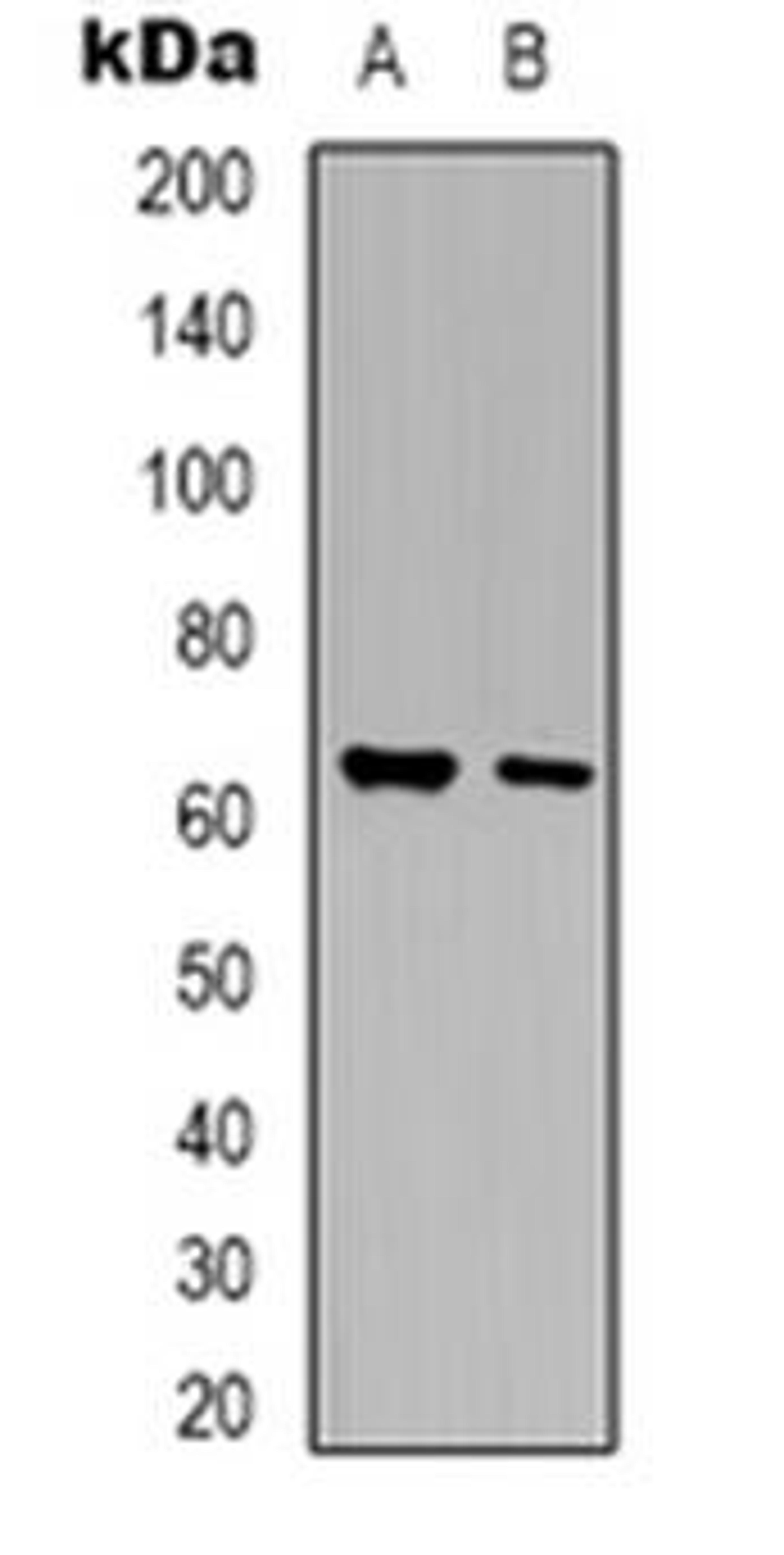 Western blot analysis of Arylsulfatase G expression in HEK293T (Lane 1), mouse liver (Lane 2) whole cell lysates using ARSG antibody