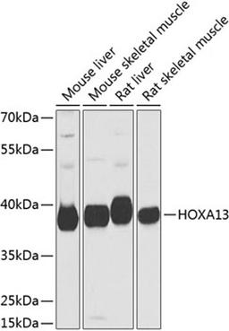 Western blot - HOXA13 antibody (A9822)