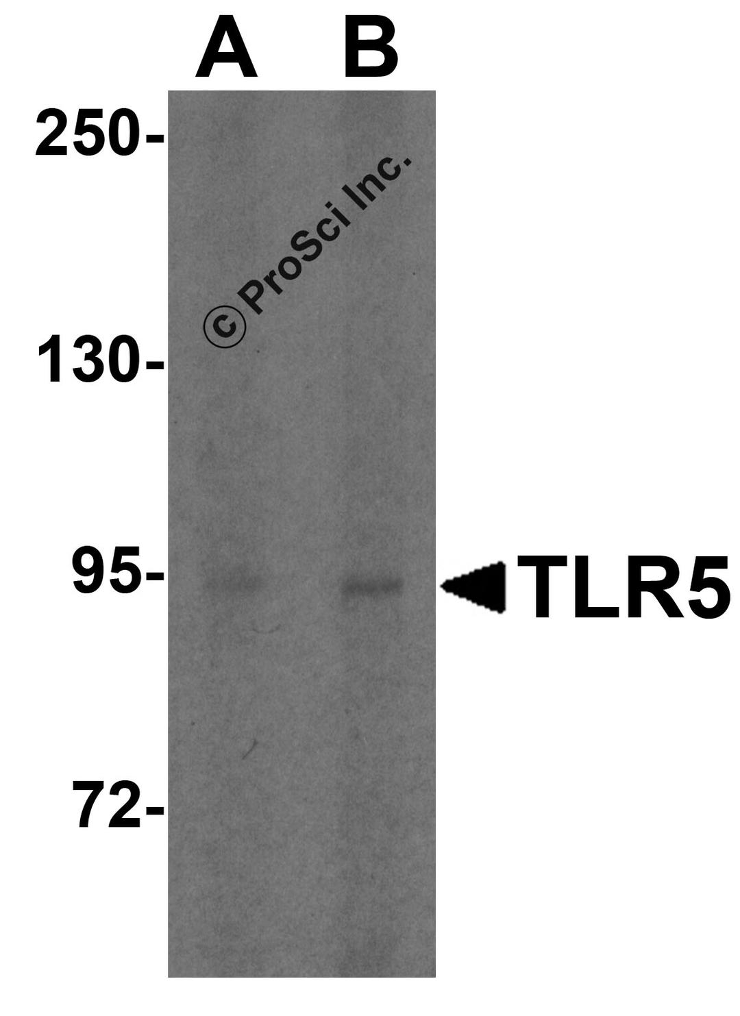 Western blot analysis of TLR5 expression in HT29 cell lysate with TLR5 antibody at (A) 1 and (B) 2 μg/ml.
