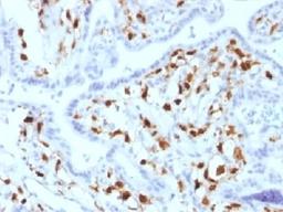 IHC testing of FFPE human placenta with Factor XIIIa antibody (clone SPM180). Required HIER: boil tissue sections in 10mM citrate buffer, pH 6, for 10-20 min.