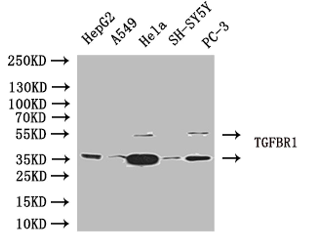 Western Blot. Positive WB detected in: Jurkat whole cell lysate, SH-SY5Y whole cell lysate. All lanes: TGFBR1 antibody at 4µg/ml. Secondary. Goat polyclonal to rabbit IgG at 1/50000 dilution. Predicted band size: 56, 57, 48 kDa. Observed band size: 56 kDa