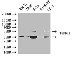 Western Blot. Positive WB detected in: Jurkat whole cell lysate, SH-SY5Y whole cell lysate. All lanes: TGFBR1 antibody at 4µg/ml. Secondary. Goat polyclonal to rabbit IgG at 1/50000 dilution. Predicted band size: 56, 57, 48 kDa. Observed band size: 56 kDa
