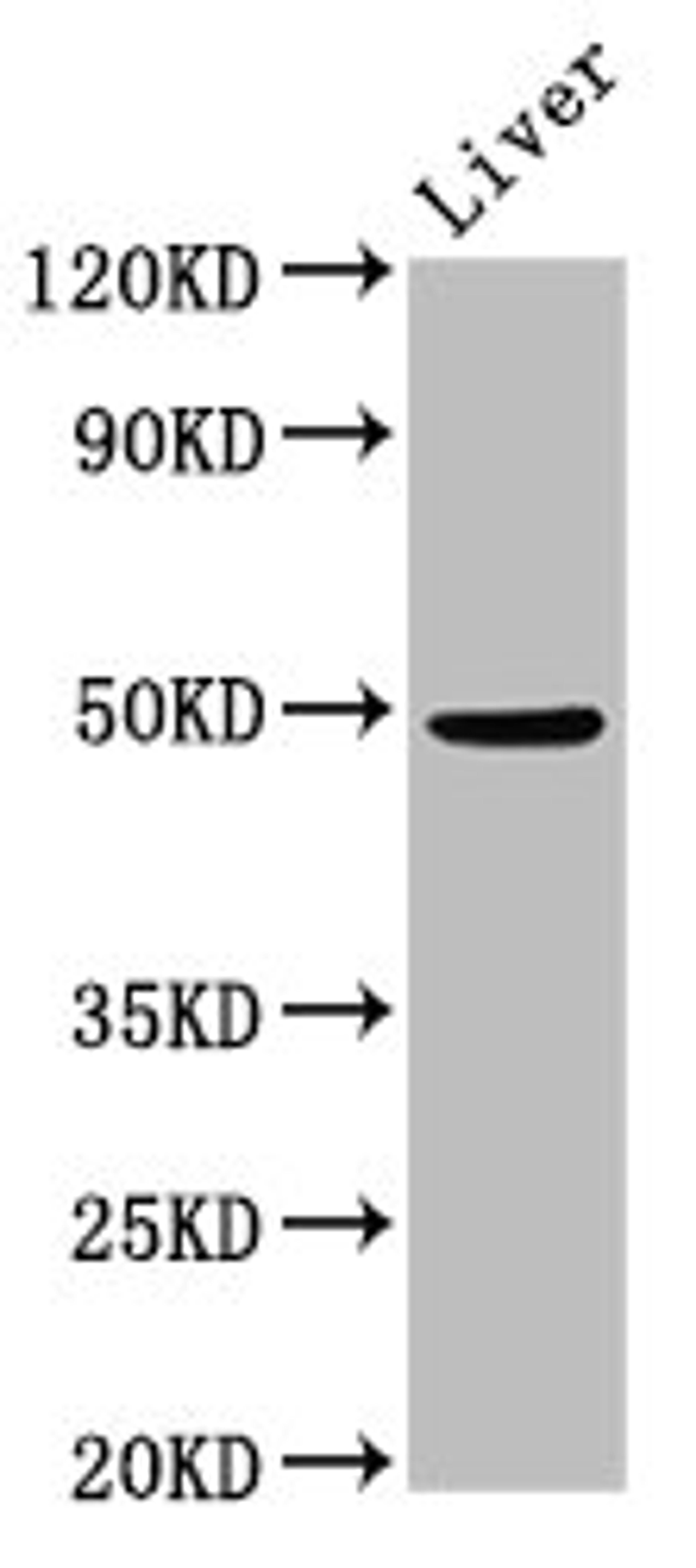 Western Blot. Positive WB detected in: Mouse liver tissue. All lanes: PPM1F antibody at 3ug/ml. Secondary. Goat polyclonal to rabbit IgG at 1/50000 dilution. Predicted band size: 50, 39 kDa. Observed band size: 50 kDa. 