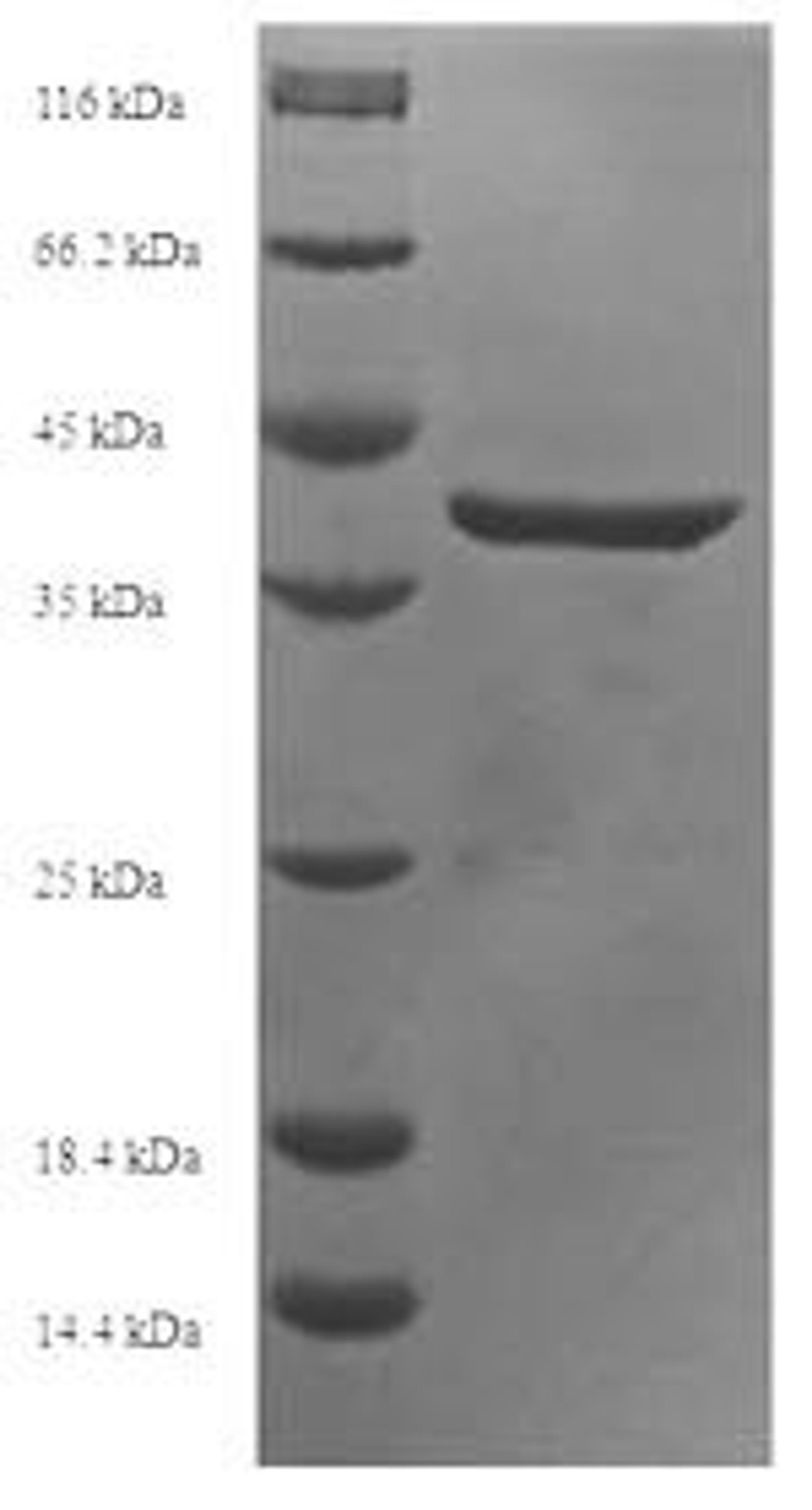 (Tris-Glycine gel) Discontinuous SDS-PAGE (reduced) with 5% enrichment gel and 15% separation gel.