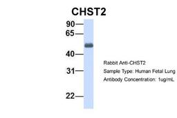 Western Blot: Carbohydrate Sulfotransferase 2/CHST2 Antibody [NBP1-59944] - Human Fetal Lung, Antibody Dilution: 1.0 ug/ml.