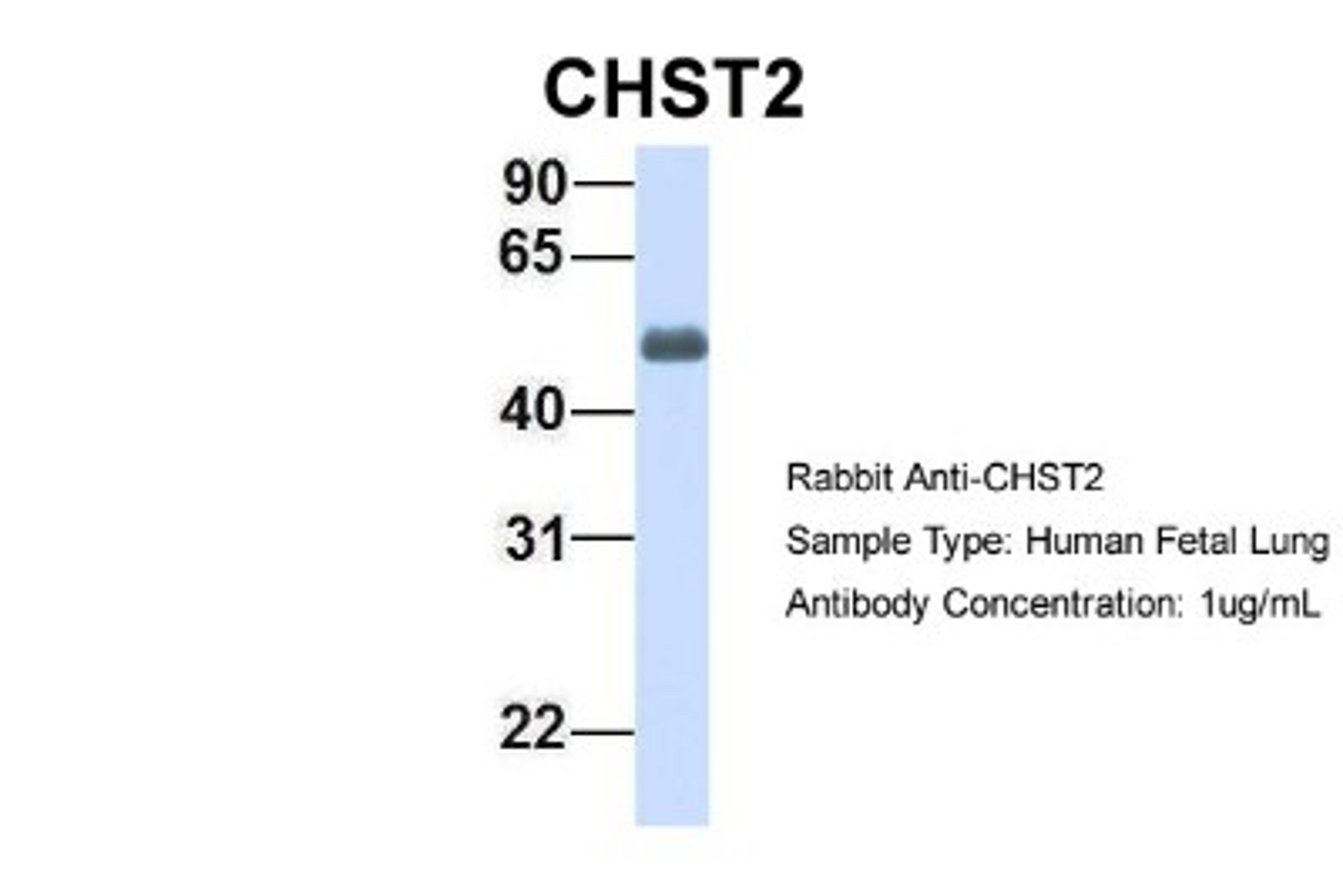 Western Blot: Carbohydrate Sulfotransferase 2/CHST2 Antibody [NBP1-59944] - Human Fetal Lung, Antibody Dilution: 1.0 ug/ml.