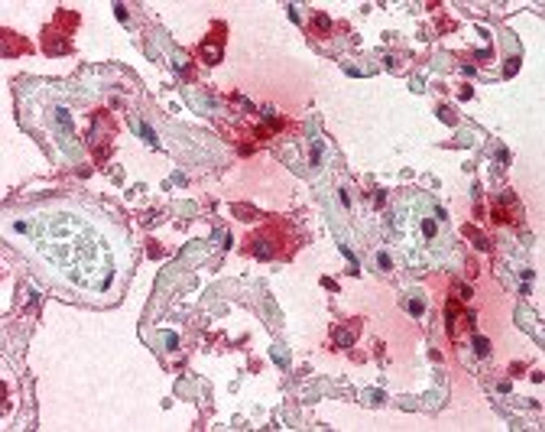 Immunohistochemistry staining of Tryptase in lung tissue using Tryptase Monoclonal Antibody.