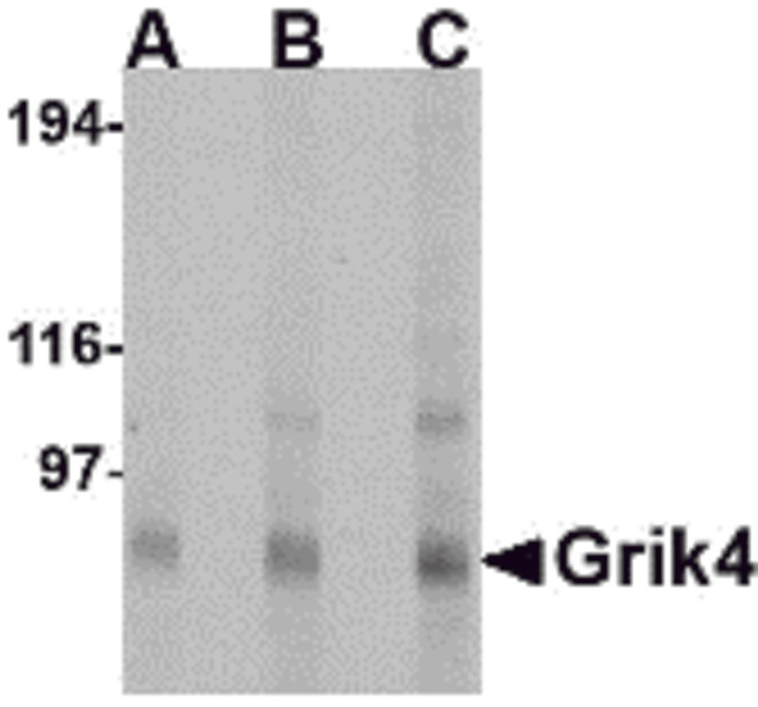 Western blot analysis of Grik4 in Rat brain tissue lysate with Grik4 antibody at (A) 0.5, (B) 1 and (C) 2 &#956;g/mL.