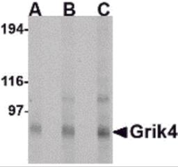 Western blot analysis of Grik4 in Rat brain tissue lysate with Grik4 antibody at (A) 0.5, (B) 1 and (C) 2 &#956;g/mL.